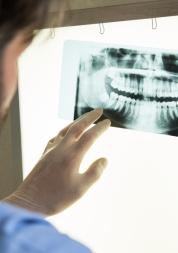 Dentist looking at a dental x-ray